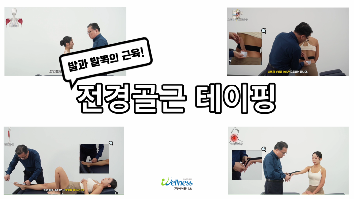 발과 발목의 핵심근육! 전경골근 테이핑