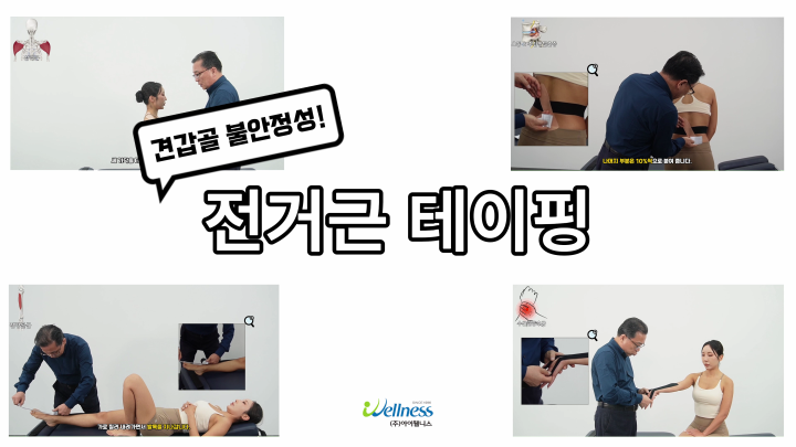 견갑골 불안정성! 전거근 테이핑