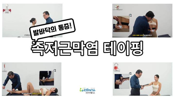 발바닥 통증! 족저근막염 테이핑