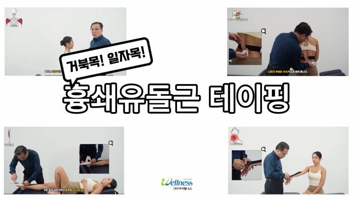 거북목 일자목! 흉쇄유돌근 테이핑