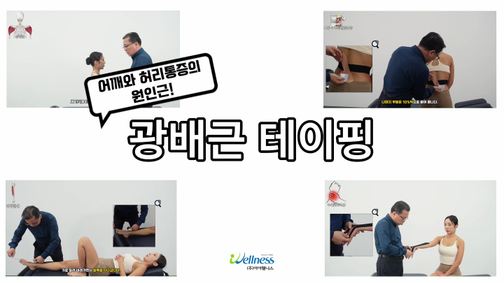 어깨와 허리통증의 원인근! 광배근 테이핑