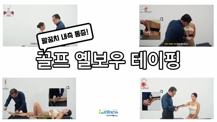 팔꿈치 내측 통증! 골프 옐보우 테이핑 요법