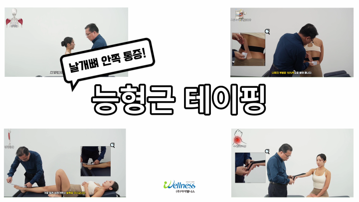 날개뼈 안쪽 통증! 능형근 테이핑