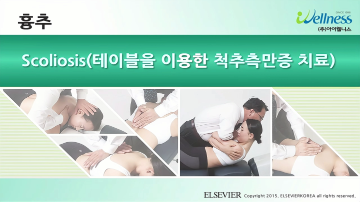 흉추_032_Scoliosis(테이블을 이용한 척추측만증 치료)_v1